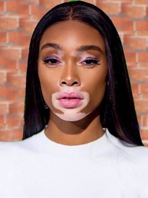 Winnie Harlow