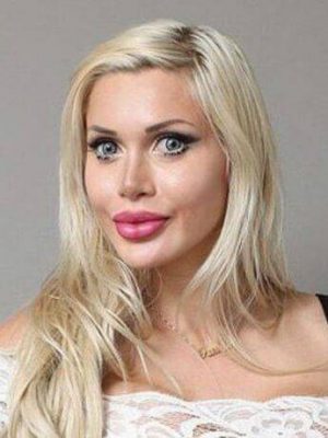 ピクシー・フォックス