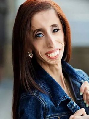 Lizzie Velasquez