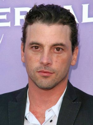 סקיט אולריך